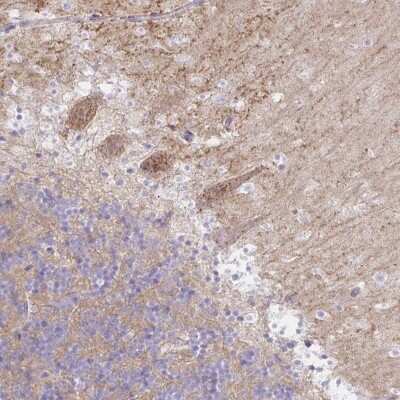 Immunohistochemistry-Paraffin: RASL10A Antibody [NBP2-34210]