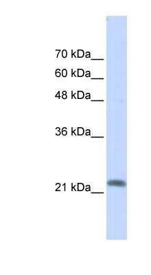 Western Blot: RASL10A Antibody [NBP1-58920]