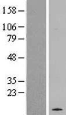 Western Blot: RASL10A Overexpression Lysate [NBL1-15173]