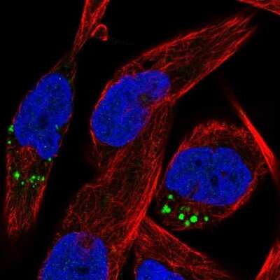 Immunocytochemistry/ Immunofluorescence: RASL10B Antibody [NBP2-38817]