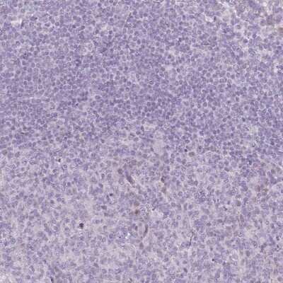 Immunohistochemistry-Paraffin: RASL10B Antibody [NBP2-13205]