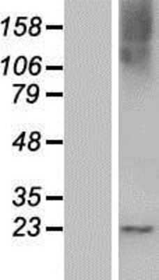 Western Blot: RASL10B Overexpression Lysate [NBP2-05891]