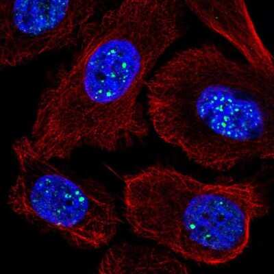 Immunocytochemistry/ Immunofluorescence: RASL11A Antibody [NBP2-58641]