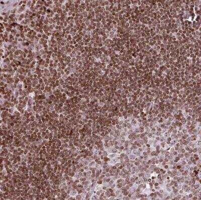 Immunohistochemistry-Paraffin: RASL11A Antibody [NBP2-30368]