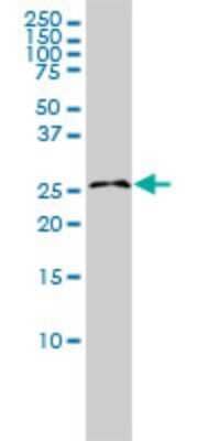 Western Blot: RASL11B Antibody (1B5) [H00065997-M01]