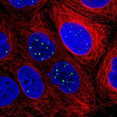 Immunocytochemistry/ Immunofluorescence: RASL11B Antibody [NBP2-31695]