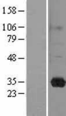 Western Blot: RASL11B Overexpression Lysate [NBL1-15174]