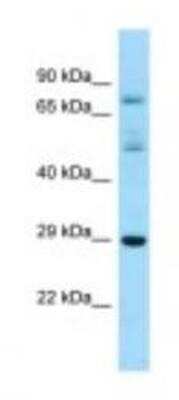 Western Blot: RASL12 Antibody [NBP1-98570]