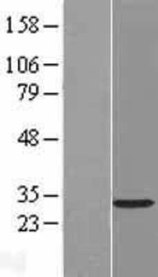 Western Blot: RASL12 Overexpression Lysate [NBL1-15175]