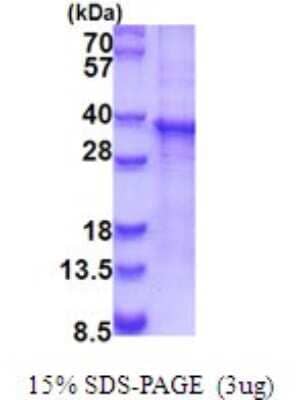 SDS-PAGE: Recombinant Human RASL12 His Protein [NBP2-51880]