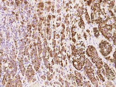 Immunohistochemistry-Paraffin: RASSF1 Antibody [NBP2-97636]