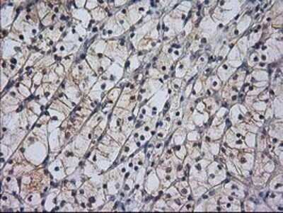 Immunohistochemistry: RASSF1 Antibody (OTI2B11) - Azide and BSA Free [NBP2-73786]