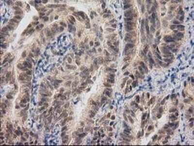 Immunohistochemistry: RASSF1 Antibody (OTI2B11) - Azide and BSA Free [NBP2-73786]
