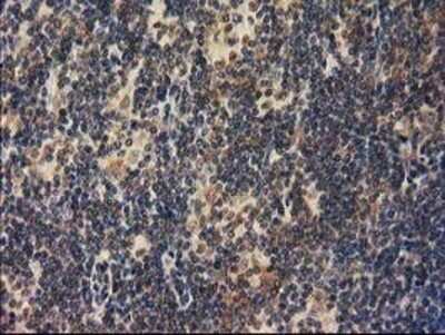 Immunohistochemistry: RASSF1 Antibody (OTI2B11) - Azide and BSA Free [NBP2-73786]