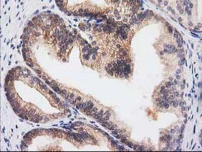 Immunohistochemistry: RASSF1 Antibody (OTI2B11) - Azide and BSA Free [NBP2-73786]