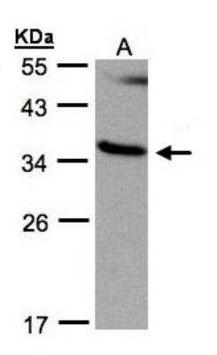 Western Blot: RASSF1 Antibody [NBP1-32361]