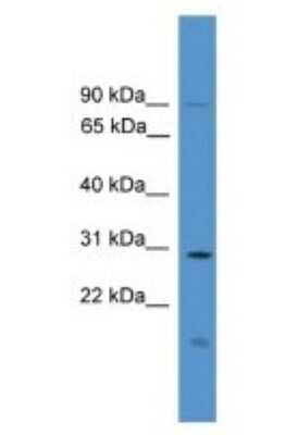 Western Blot: RASSF1 Antibody [NBP1-69094]