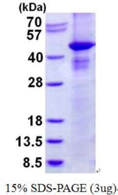 SDS-PAGE: Recombinant Human RASSF1 His Protein [NBP2-23397]