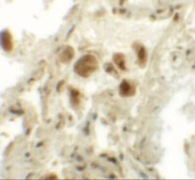 Immunohistochemistry: RASSF10 Antibody - BSA Free [NBP2-41130]