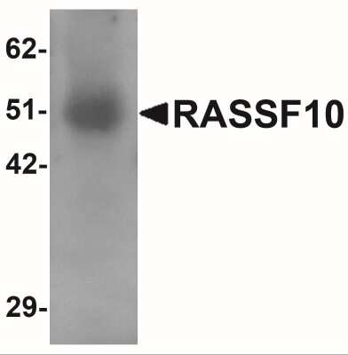 Western Blot: RASSF10 AntibodyBSA Free [NBP2-41130]