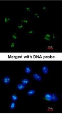Immunocytochemistry/ Immunofluorescence: RASSF2 Antibody [NBP1-32571]
