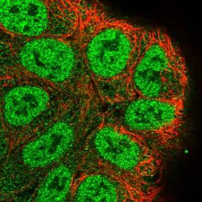 Immunocytochemistry/ Immunofluorescence: RASSF2 Antibody [NBP2-13206]