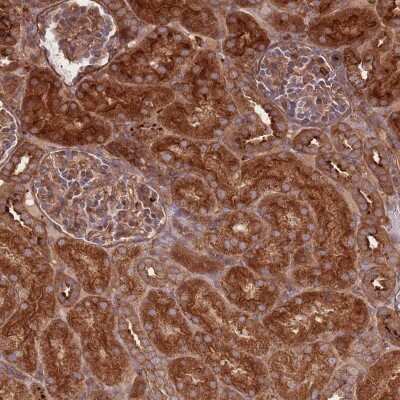 Immunohistochemistry-Paraffin: RASSF2 Antibody [NBP2-13206]