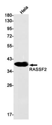 Western Blot: RASSF2 Antibody (S06-2H4) [NBP3-19757]