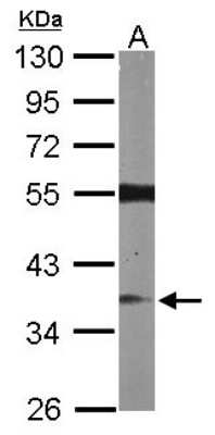 Western Blot: RASSF2 Antibody [NBP1-32571]
