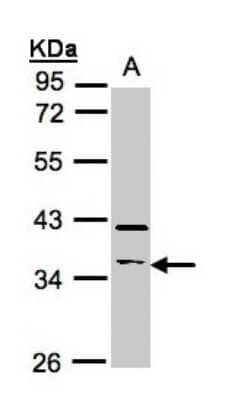 Western Blot: RASSF2 Antibody [NBP1-32571]