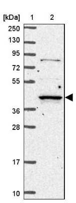 Western Blot: RASSF2 Antibody [NBP2-13206]