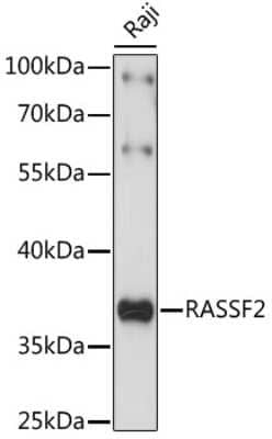 Western Blot: RASSF2 AntibodyAzide and BSA Free [NBP2-93559]