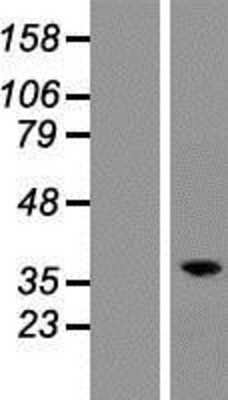 Western Blot: RASSF2 Overexpression Lysate [NBP2-05205]