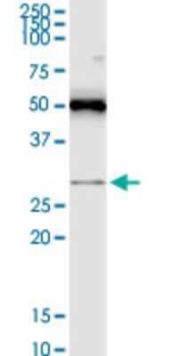 Western Blot: RASSF3 Antibody (3A5) [H00283349-M15]