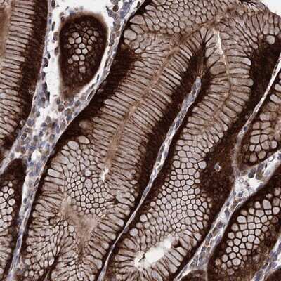 Immunohistochemistry-Paraffin: RASSF3 Antibody [NBP1-89425]