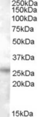 Western Blot: RASSF3 Antibody [NBP1-20967]