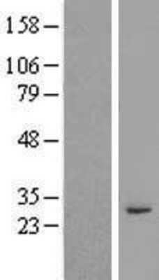 Western Blot: RASSF3 Overexpression Lysate [NBP2-04990]