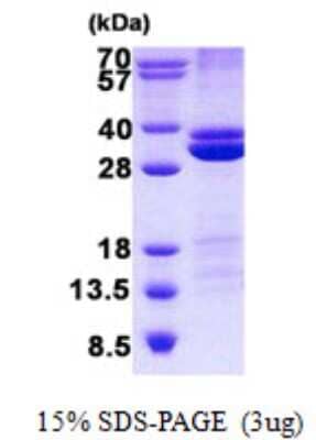 SDS-PAGE: Recombinant Human RASSF3 His Protein [NBP2-23398]