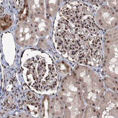 Immunohistochemistry-Paraffin: RASSF4 Antibody [NBP1-89249]