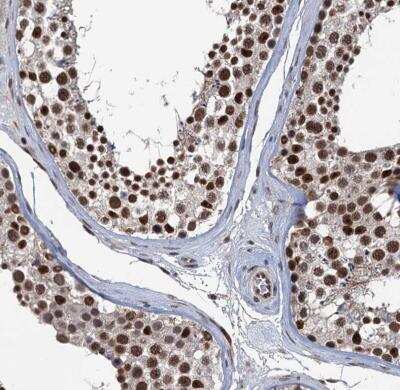 Immunohistochemistry-Paraffin: RASSF4 Antibody [NBP1-89249]