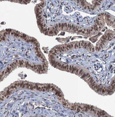 Immunohistochemistry-Paraffin: RASSF4 Antibody [NBP1-89249]