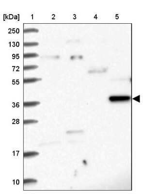 Western Blot: RASSF4 Antibody [NBP1-89249]