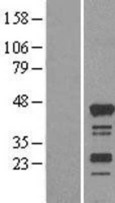 Western Blot: RASSF4 Overexpression Lysate [NBL1-15178]