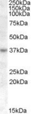 Western Blot: RASSF7 Antibody [NB100-93434]