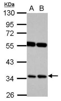 Western Blot: RASSF7 Antibody [NBP2-15091]