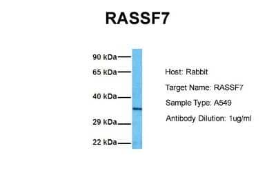 Western Blot: RASSF7 Antibody [NBP2-88128]