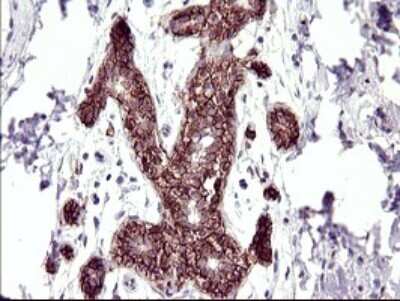 Immunohistochemistry: RASSF8 Antibody (OTI1F5) [NBP2-45530]