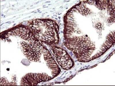 Immunohistochemistry: RASSF8 Antibody (OTI1F5) [NBP2-45530]