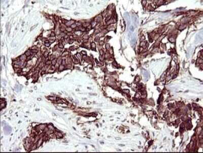 Immunohistochemistry: RASSF8 Antibody (OTI1F5) [NBP2-45530]