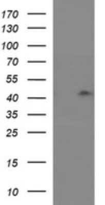 Western Blot: RASSF8 Antibody (OTI1F5) [NBP2-45530]